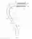Fig. 03 - Adjustable lighted walking aid