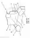 Fig. 02 - Compact spillover fitting and method of use thereof