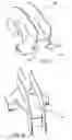 Fig. 07 - Compact spillover fitting and method of use thereof