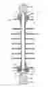 Fig. 01 - Corona shield and composite insulator with corona shield