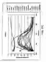 Fig. 28 - Infrared blocking article