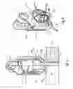 Fig. 10 - LOAD TAKE-UP DEVICE FOR INTRODUCING LOAD FORCES SUCH AS CABLE FORCES OR TENSION FORCES OF FLAT STRUCTURES