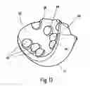 Fig. 11 - LOAD TAKE-UP DEVICE FOR INTRODUCING LOAD FORCES SUCH AS CABLE FORCES OR TENSION FORCES OF FLAT STRUCTURES