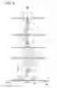 Fig. 05 - Transmission electron microscope and method for observing specimen image with the same