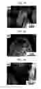 Fig. 07 - Laser-induced structuring of substrate surfaces