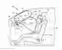 Fig. 01 - Dual volume air bag