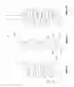 Fig. 09 - Stirring system with interspaced stirring elements and baffles, and method for homogenizing glass melts