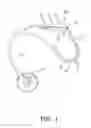 Fig. 02 - HEARING AID