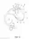 Fig. 07 - HEARING AID