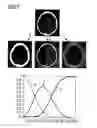Fig. 07 - CT image reconstruction for improving temporal resolution in cardio CT