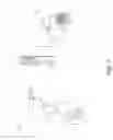 Fig. 08 - Grid suppression in imaging