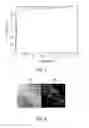 Fig. 04 - System and method for coronary digital subtraction angiography