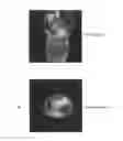 Fig. 01 - MOLECULAR PROBE FOR IMAGING OF PANCREATIC ISLET AND THE PRECURSOR, AND USE OF THE SAME