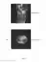 Fig. 06 - MOLECULAR PROBE FOR IMAGING OF PANCREATIC ISLET AND THE PRECURSOR, AND USE OF THE SAME