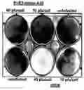 Fig. 01 - Use of adenovirus and nucleic acids coding therefor