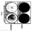 Fig. 06 - Use of adenovirus and nucleic acids coding therefor