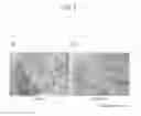 Fig. 06 - Method for isolating smooth muscle stem cells