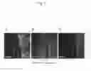 Fig. 08 - Method for isolating smooth muscle stem cells