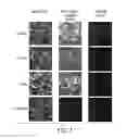 Fig. 02 - COMPOSITIONS AND METHODS FOR THE THERAPY AND DIAGNOSIS OF INFLUENZA