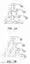 Fig. 02 - PROSPECTIVE IDENTIFICATION AND CHARACTERIZATION OF BREAST CANCER STEM CELLS
