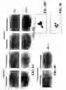 Fig. 13 - PROSPECTIVE IDENTIFICATION AND CHARACTERIZATION OF BREAST CANCER STEM CELLS