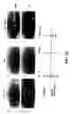 Fig. 18 - PROSPECTIVE IDENTIFICATION AND CHARACTERIZATION OF BREAST CANCER STEM CELLS