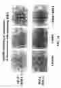 Fig. 24 - PROSPECTIVE IDENTIFICATION AND CHARACTERIZATION OF BREAST CANCER STEM CELLS