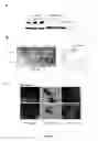 Fig. 08 - HER3 AS A DETERMINANT FOR THE PROGNOSIS OF MELANOMA