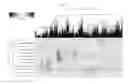 Fig. 27 - GENE EXPRESSION MARKERS FOR CROHN'S DISEASE