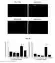 Fig. 03 - AGENTS AND METHODS FOR TREATMENT OF ANXIETY DISORDERS