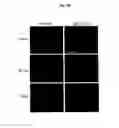 Fig. 11 - AGENTS AND METHODS FOR TREATMENT OF ANXIETY DISORDERS