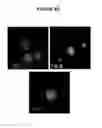 Fig. 10 - ARTICLES AND METHODS FOR REPAIRING DAMAGED NERVOUS TISSUE