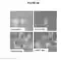 Fig. 12 - ARTICLES AND METHODS FOR REPAIRING DAMAGED NERVOUS TISSUE