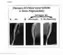 Fig. 09 - METHODS AND COMPOSITIONS FOR BONE HEALING BY PERIOSTIN