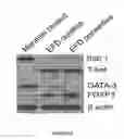 Fig. 06 - Preparation Comprising Mycobacterium Bovis BCG Killed by Extended Freeze Drying (EFD) for Preventing or Treating Rheumatoid Arthritis