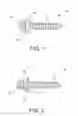 Fig. 02 - Anchor apparatus and method for orthodontic appliances