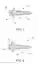 Fig. 06 - Anchor apparatus and method for orthodontic appliances