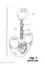 Fig. 02 - Dental implant