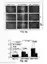 Fig. 06 - Peptide sequence that promotes tumor invasion