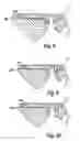 Fig. 11 - Golf club head