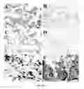 Fig. 07 - Monoclonal antibodies with binding specificity for response gene to complement 32 (RGC-32)
