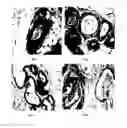 Fig. 02 - Methods for Therapeutic Treatment of Benign Prostatic Hypertrophy (BPH)