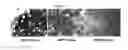 Fig. 02 - Use of IMP3 as a prognostic marker for cancer