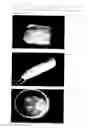 Fig. 04 - Use of pharmaceutical compound in the treatment of wounds