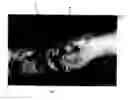 Fig. 07 - Use of pharmaceutical compound in the treatment of wounds