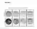 Fig. 02 - Compositions and methods modulating MG29 for the treatment of diabetes