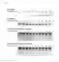 Fig. 09 - Double-stranded lipid-modified RNA having high RNA interference effect