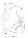 Fig. 08 - Devices and methods for absorbing, transferring and delivering heart energy