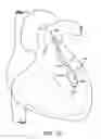 Fig. 09 - Devices and methods for absorbing, transferring and delivering heart energy