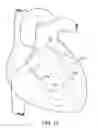 Fig. 12 - Devices and methods for absorbing, transferring and delivering heart energy